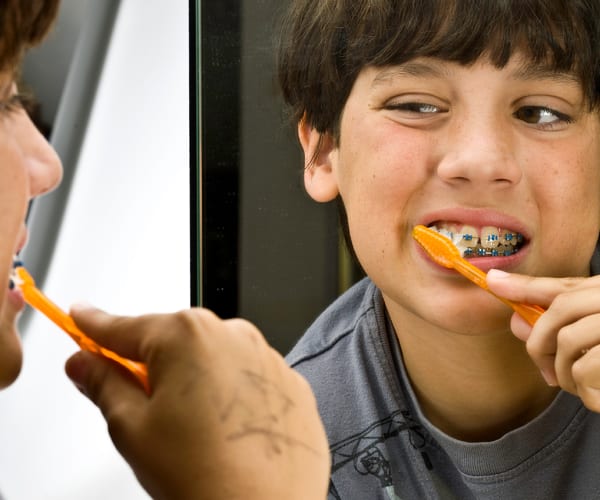 Brushing Techniques With Braces