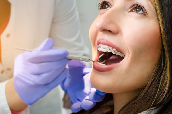 Common Questions About Orthodontic Treatment