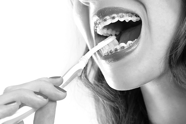 Oral Hygiene Tips For People With Braces