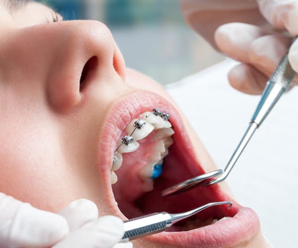 Orthodontic Treatment Can Prevent Serious Dental Issues