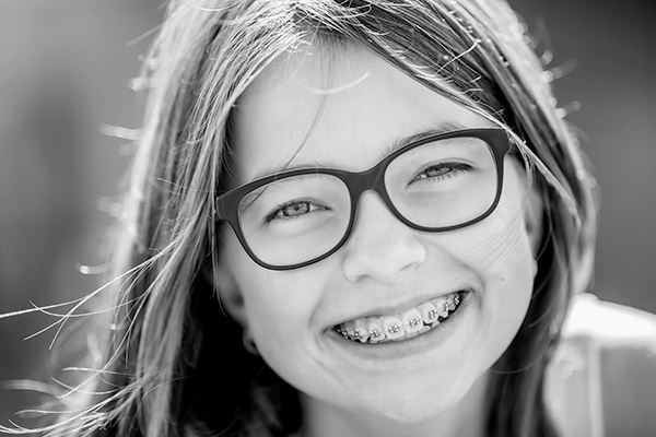 Preventative Orthodontic Treatment in Montreal