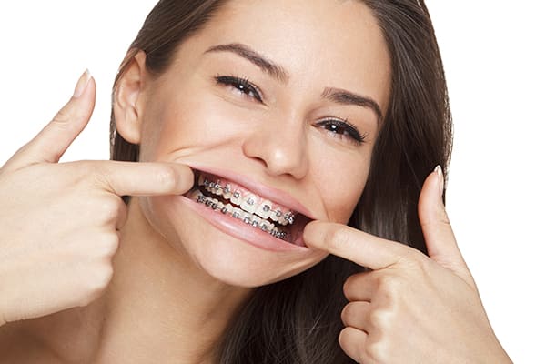 Talking With Braces